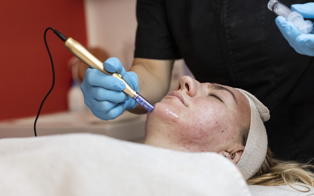 Cos’è la microdermoabrasione?